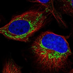 ZNF678 Antibody, Novus Biologicals:Antibodies:Primary Antibodies